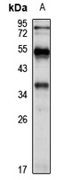 TMEM74 Rabbit Polyclonal Antibody