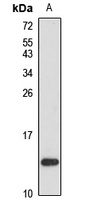 FN14 Rabbit Polyclonal Antibody