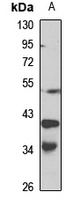 DCR3 Rabbit Polyclonal Antibody