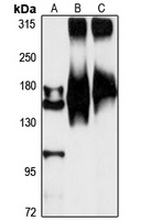 TNR Antibody