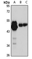 p53 Rabbit Polyclonal Antibody