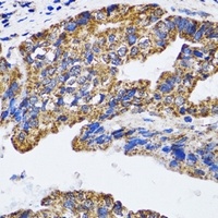 p53 Rabbit Polyclonal Antibody