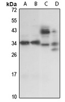PRPK Rabbit Polyclonal Antibody