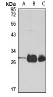 TPK1 Rabbit Polyclonal Antibody