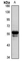 TRHR Rabbit Polyclonal Antibody