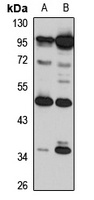 TRIM15 Rabbit Polyclonal Antibody