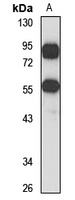 TRIM17 Rabbit Polyclonal Antibody
