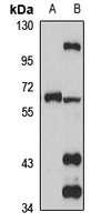 TRIM45 Rabbit Polyclonal Antibody