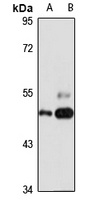 TRIM5 Rabbit Polyclonal Antibody