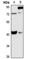 TRIM54 Rabbit Polyclonal Antibody