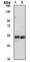 TRIM62 Rabbit Polyclonal Antibody