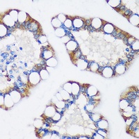 TRIM62 Rabbit Polyclonal Antibody