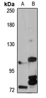 TRPM5 Rabbit Polyclonal Antibody