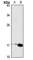 TSLP Antibody