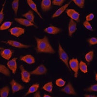 TSLP Antibody