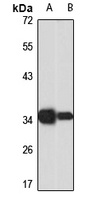 TSPY3 Rabbit Polyclonal Antibody