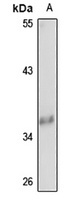 TTC1 Rabbit Polyclonal Antibody