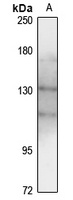 TYK2 Antibody