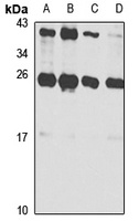 UBE2K Rabbit Polyclonal Antibody