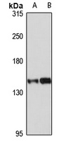 UBE4B Rabbit Polyclonal Antibody