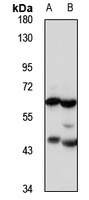 UGT1A4 Rabbit Polyclonal Antibody