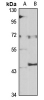 UGT1A4 Rabbit Polyclonal Antibody