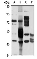 UGT2B4 Rabbit Polyclonal Antibody
