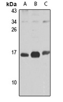 UQCC2 Rabbit Polyclonal Antibody