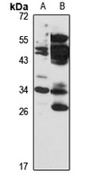 USB1 Rabbit Polyclonal Antibody