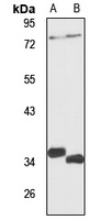 USP18 Rabbit Polyclonal Antibody