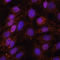 USP18 Rabbit Polyclonal Antibody
