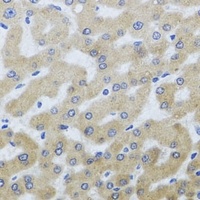 UVRAG Antibody