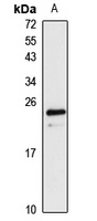 VPS29 Antibody