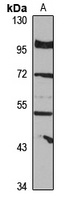 VRK2 Rabbit Polyclonal Antibody