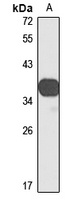 VSX1 Rabbit Polyclonal Antibody