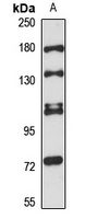 WDR35 Rabbit Polyclonal Antibody