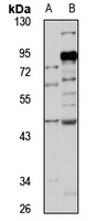 WDR4 Rabbit Polyclonal Antibody