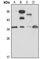 WDR61 Rabbit Polyclonal Antibody