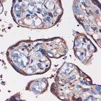 WDR61 Rabbit Polyclonal Antibody