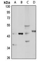 WISP1 Rabbit Polyclonal Antibody