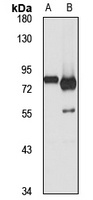 ZFP64 Rabbit Polyclonal Antibody