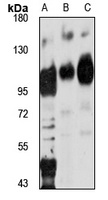 ZFX Rabbit Polyclonal Antibody