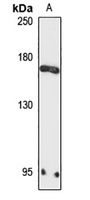 ZMYM3 Rabbit Polyclonal Antibody