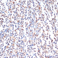 ZMYM3 Rabbit Polyclonal Antibody