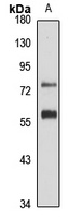ZNF277 Rabbit Polyclonal Antibody