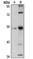 ZNF3 Rabbit Polyclonal Antibody