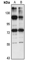 ZNF598 Rabbit Polyclonal Antibody