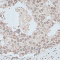 ZNF703 Rabbit Polyclonal Antibody