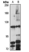 ZNRF3 Rabbit Polyclonal Antibody