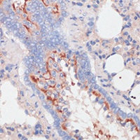 ZNRF3 Rabbit Polyclonal Antibody